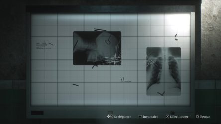 Image d'illustration pour l'article : Puzzle de l'appareil de radiologie - Silent Hill 2 Remake
