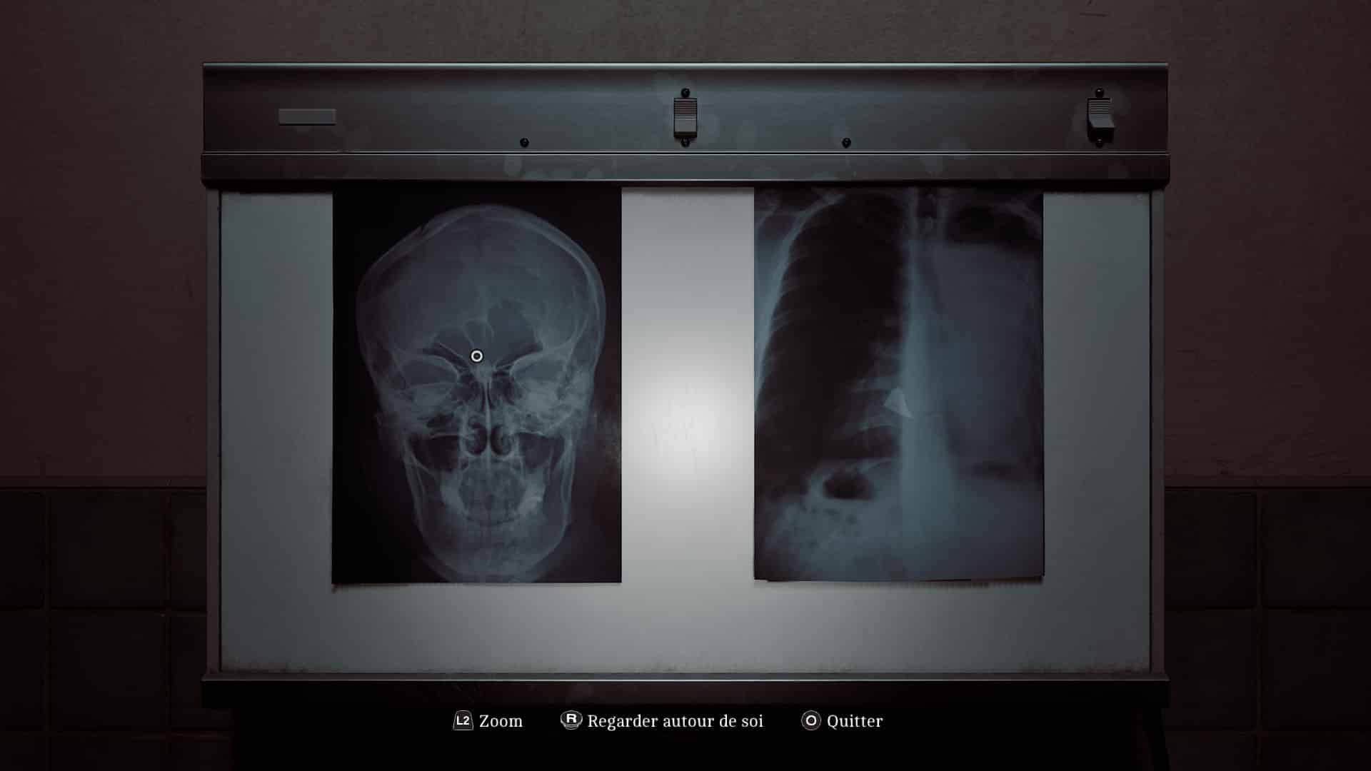 Silent hill townfall diagnostic patient 17 14 Silent hill townfall diagnostic patient 17 14